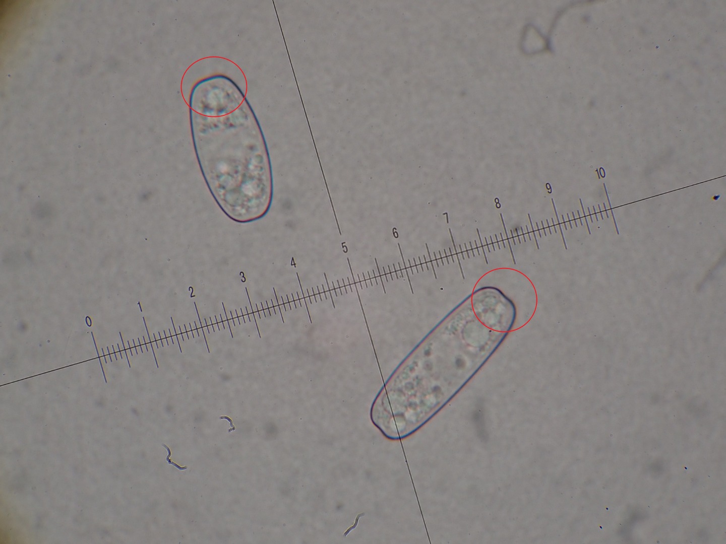 Sporen von Sarcoscypha austriaca (x1000)