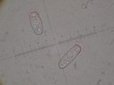 Sporen von Sarcoscypha austriaca (x1000)